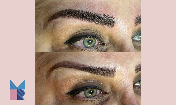 همه چیز در مورد کاشت ابرو